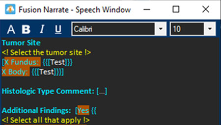 Improvements have been made to the speech window for a more simplified dictation workflow